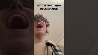 Богдан Вандышев несмыкание связок