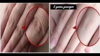 How to Make Your Hands Look 5 Years Younger Overnight! Wrinkle-free smooth fair hands