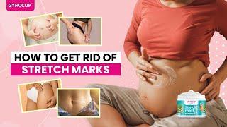 Gynocup Stretch Mark Removal Kit For Pregnancy | Gynocup | Mildcares