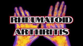 Rheumatoid Arthritis (updated 2023) - CRASH! Medical Review Series