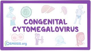 Congenital CMV - causes, symptoms, diagnosis, treatment, pathology