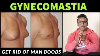 Gynecomastia | How to get rid of Man Boobs | Yatinder Singh