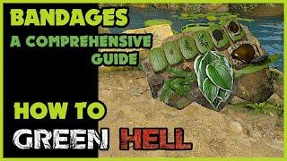 Bandages: A Comprehensive Guide | How to Green Hell | Survival Tips S01 E01