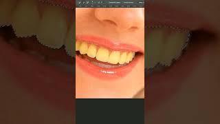 realistic way to whiten teeth in photoshop #shorts