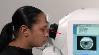 How do I acquire a high-quality scan on my CIRRUS HD-OCT Part 2 Fundus alignment