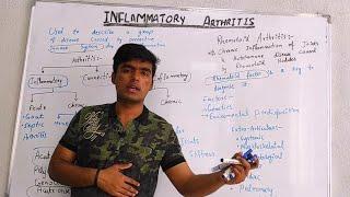 INFLAMMATORY ARTHRITIS | CLASSIFICATIONS | RISK FACTORS | DIAGNOSIS | TREATMENTS