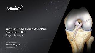 GraftLink® All-Inside ACL/PCL Reconstruction