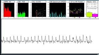 Pulse Sensor Amped Cardio Graph Processing Code II