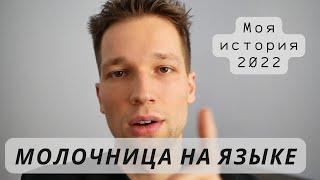 Молочница на языке 2022 . Моя история про кандидоз ротовой полости