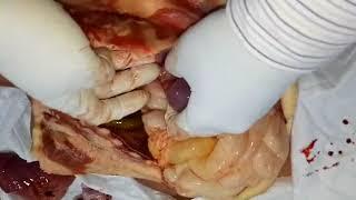 Removal of Spleen and Liver