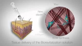 In vitro study of RRS HA injectable mesotherapy - Video abstract [95108]