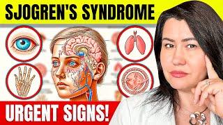 10 Vital Signs of Sjogren's Syndrome You Can't Ignore