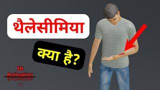 थैलेसीमिया क्या है? | What is Thalassemia? | 3D Animation 