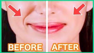 Get Rid Of Smile Lines with This Massage️! (Nasolabial Folds/ Laugh Lines)