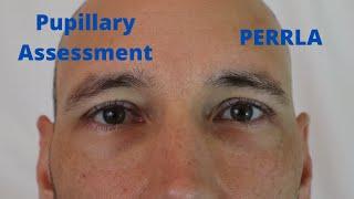 Pupillary Assessment (PERRLA)