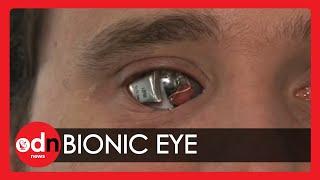 Man sees with 'bionic eye'