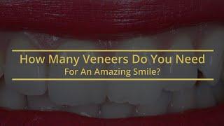 How Many Dental Veneers Do You Need For a Great Smile?