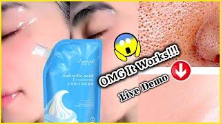 Viral salicylic Acid Ice cream Mask /Review & Demo #icecreammassk #salicylicacid