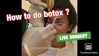 MA TECHNIQUE POUR BIEN FAIRE DES INJECTIONS DE BOTOX AU VISAGE. HOW DO DO BOTOX INJECTIONS.