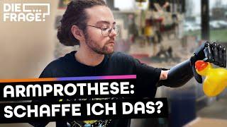 60.000€-Prothese: Zahlt die Krankenkasse?