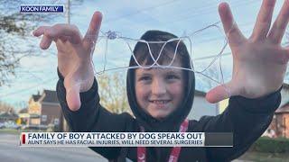 Family of boy attacked by dog speaks out