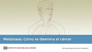 Metástasis: Cómo se disemina el cáncer