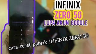 INFINIX ZERO 5G LUPA POLA,LUPA PIN TANPA PC,CARA MENGATASI INFINIX ZERO 5G LUPA POLA/PIN GRATIISS