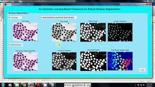 An Automatic Learning-Based Framework for Robust Nucleus Segmentation | Matlab IEEE Project