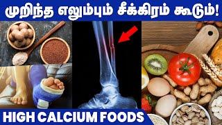 How to Heal Fractured Bone Fast? | Bone Building Foods