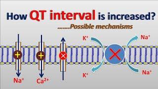 Increase in QT interval || Possible mechanisms