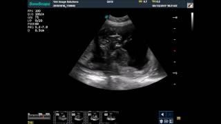 Late canine pregnancy on ultrasound