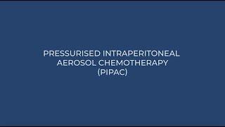 PIPAC - Pressurised IntraPeritoneal Aerosolised Chemotherapy