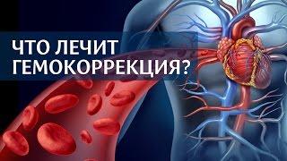 Что лечит экстракорпоральная гемокоррекция крови?