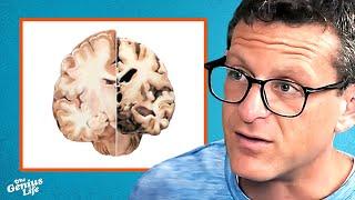 How Likely Is It For You To Develop Alzheimer's Disease? - Dr. Richard Isaacson