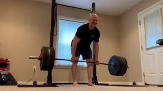 365 deadlift 6 months post hip replacement