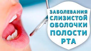Тактика врача-стоматолога при заболеваниях слизистой оболочки полости рта| Дентал ТВ