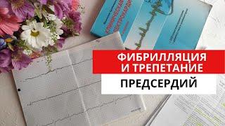 ЭКГ диагностика нарушений ритма сердца. Фибрилляция и трепетание предсердий.