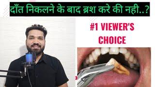 #1 VIEWER'S CHOICE, दाँत निकलवाने के बाद ब्रश कर सकते है क्या??