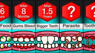 Comparison: If You Never Brushed Your Teeth Again