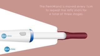 FemiWand Vaginal Tightening  - How does it work?