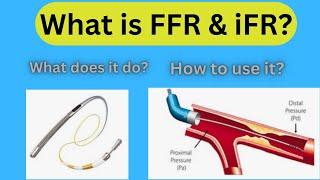What is FFR 0r iFR? How does it work?