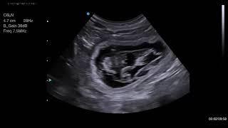 32 day canine pregnancy scan