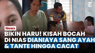 BIKIN HARU! Kisah Bocah di Nias Dianiaya Sang Ayah dan Tante hingga Cacat Permanen