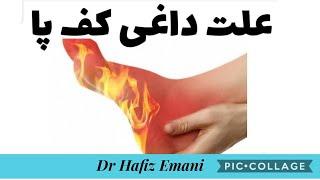 علت داغ آمدن و سوزش کف پا چیست | peripheral neuropathy