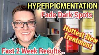 FADE DARK SPOTS FAST - The New Hyperpigmentation Skincare That Works!