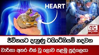 ජීවිතයට දැනුණු ටයිටේනියම් හදවත | වාර්තා අතර එක් වූ ලොව පළමු පුද්ගලයා