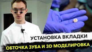 Коронка вкладка на зуб CEREC и профессиональная чистка зубов за 3.5 часа #vitazahnfabrik Suprinity