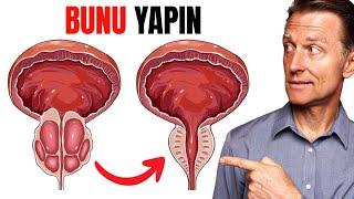 Büyümüş Prostatı Küçülten TEK YİYECEK | Dr. Berg Türkçe