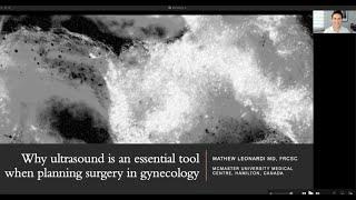 Why ultrasound is an essential tool when planning gynecologic surgery - ISUOG 30th Anniversary