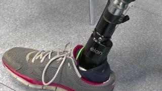 New prosthetic limbs provides sensation and mobility